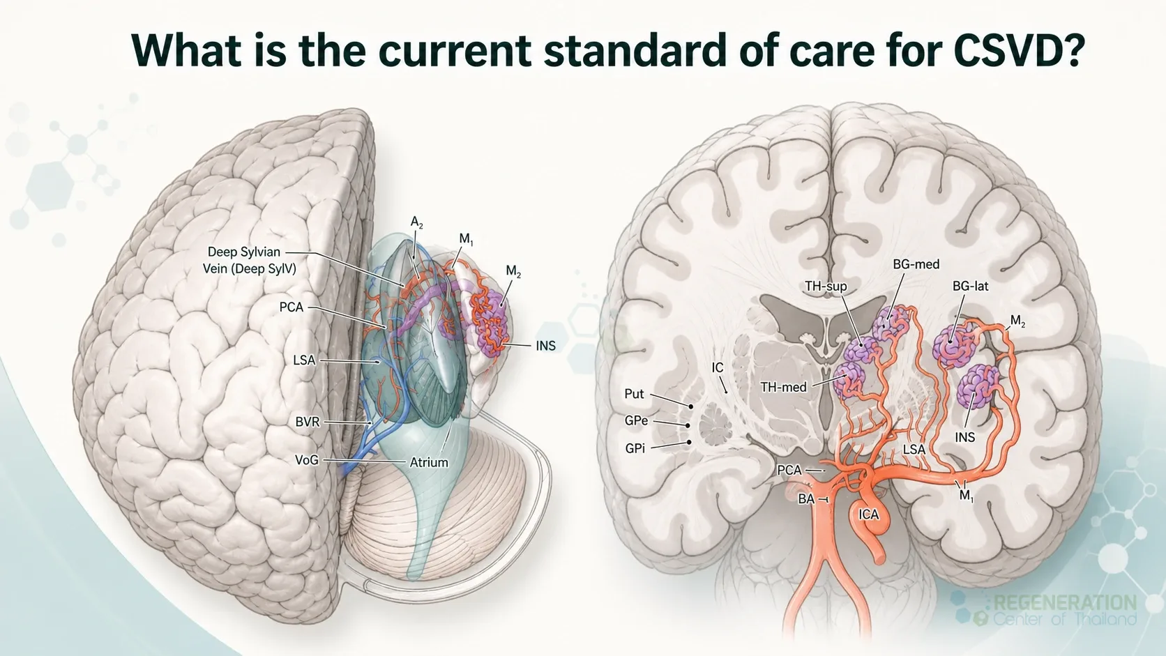 cerebral-small-vessel-disease-brain-blood-supply-anatomy for Stem Cell Treatment for Cerebral Small Vessel Disease (CSVD).