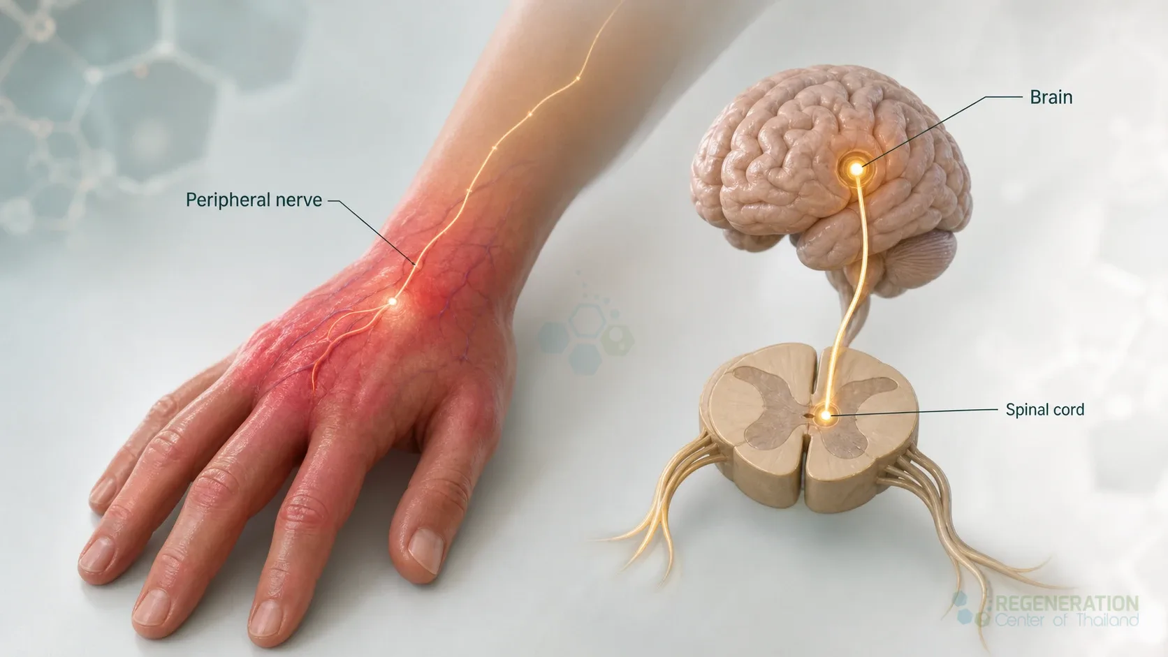 Diagram connecting regional pain, swelling and vascular changes with a recurring pain cycle for Stem Cell Treatment for Complex Regional Pain Syndrome (CRPS).