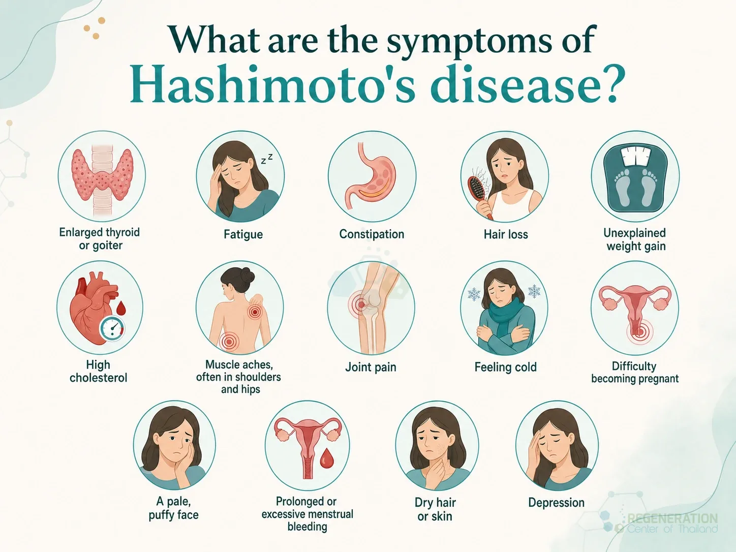 Infographic illustrating common symptoms of Hashimoto's thyroiditis for Stem Cell Treatment for Hashimoto’s Disease & Chronic Thyroiditis.