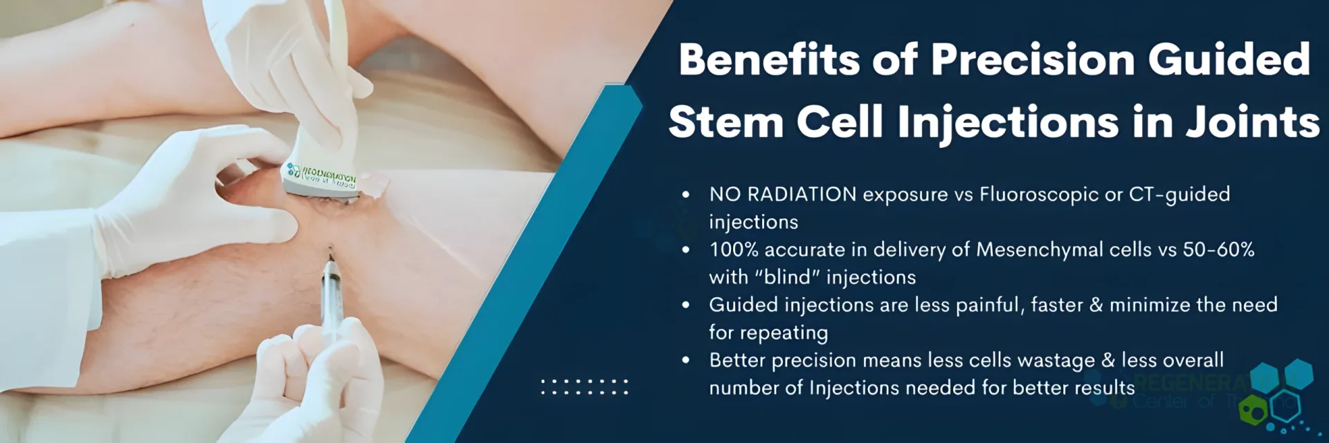 Ultrasound-guided-stem-cell-injections-Joints for Stem Cell Treatment for Osteoarthritis & Gout Arthritis Therapy.