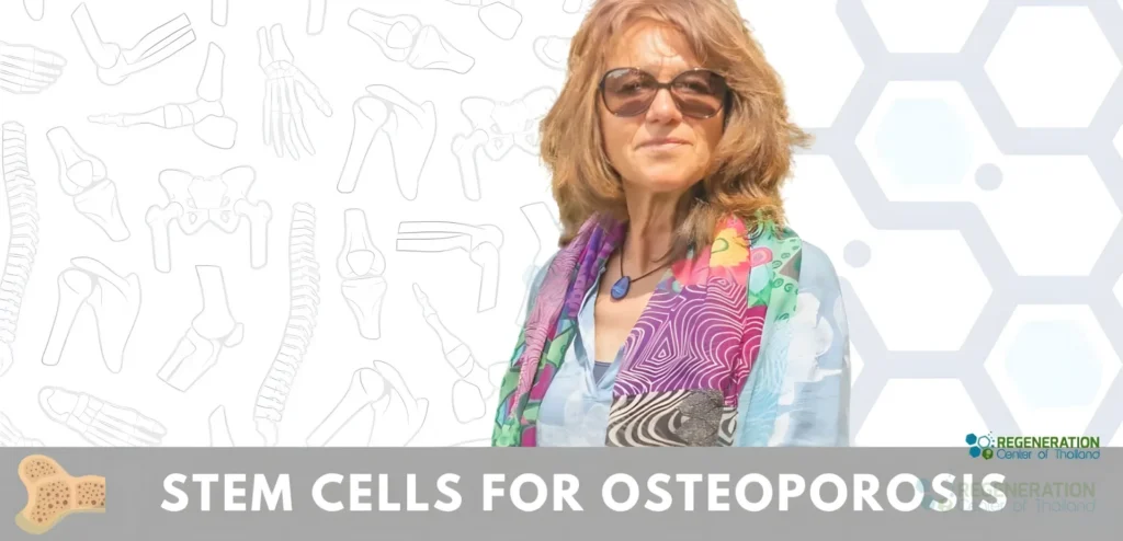 Enhanced visual alternative for Stem Cell Treatment for Osteoporosis bone fractures – media repair