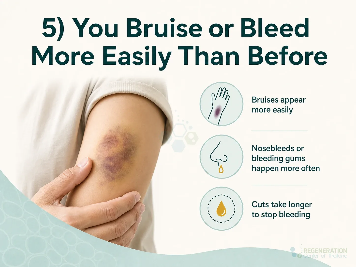 Clean clinical illustration for 5) You Bruise or Bleed More Easily Than Before with concise explanatory text.