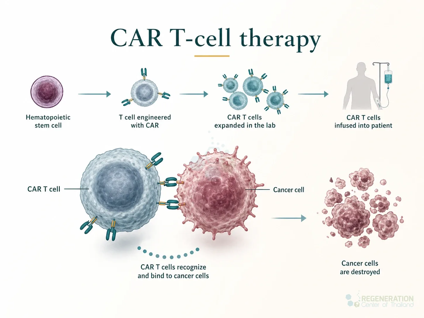 Clinical editorial image for CAR T-cell therapy, including the section headline.