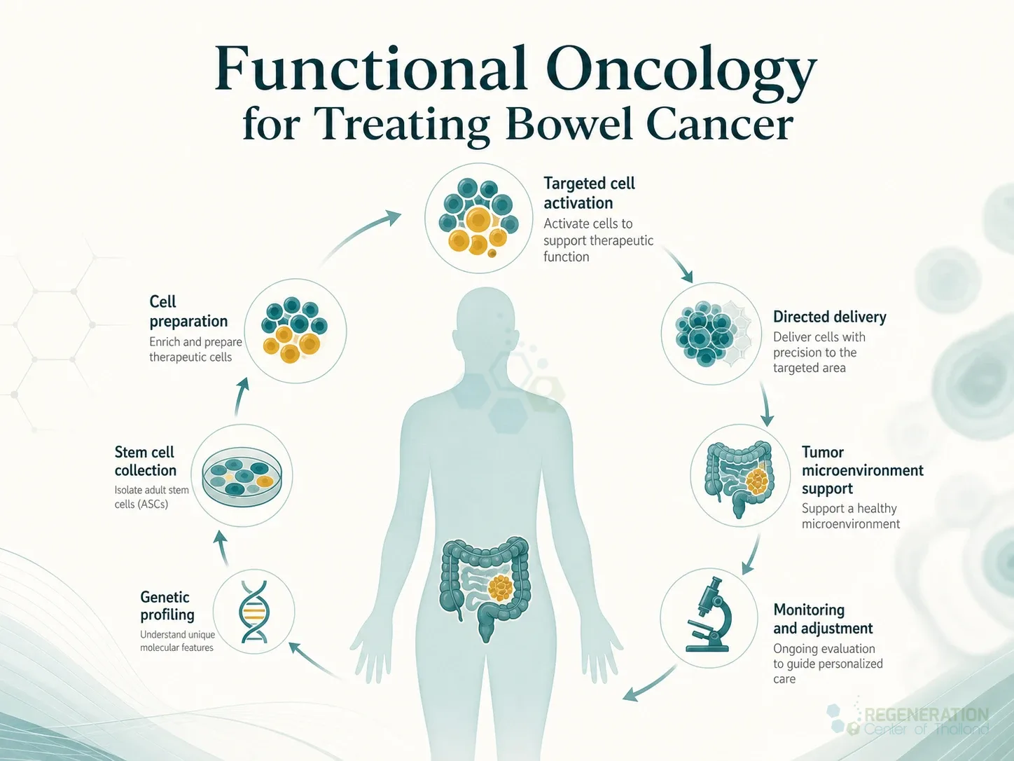 Clean clinical illustration for Functional Oncology for Treating Bowel Cancer with concise explanatory text.