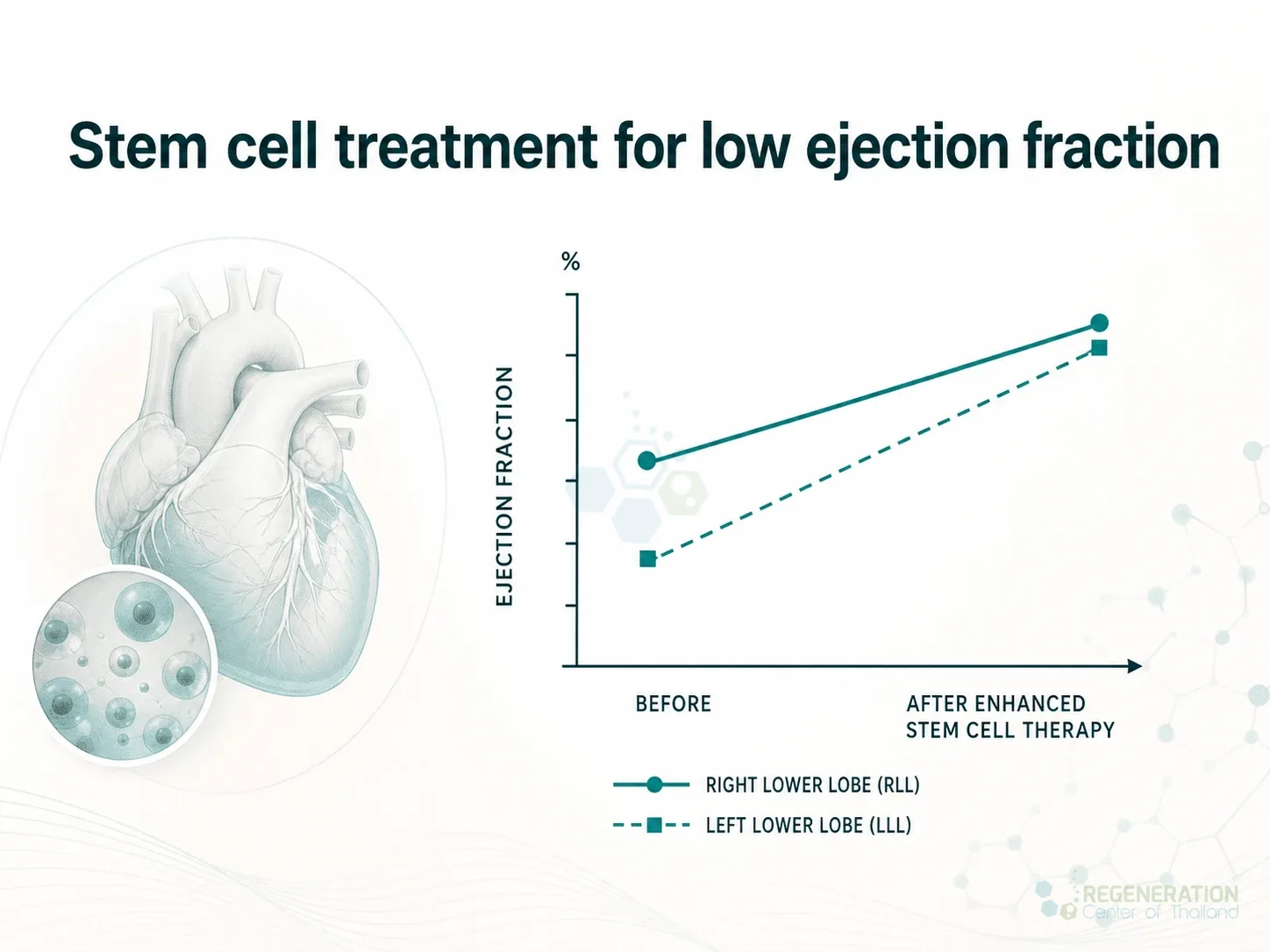 Clinical editorial image for Stem cell treatment for low ejection fraction, including the section headline.