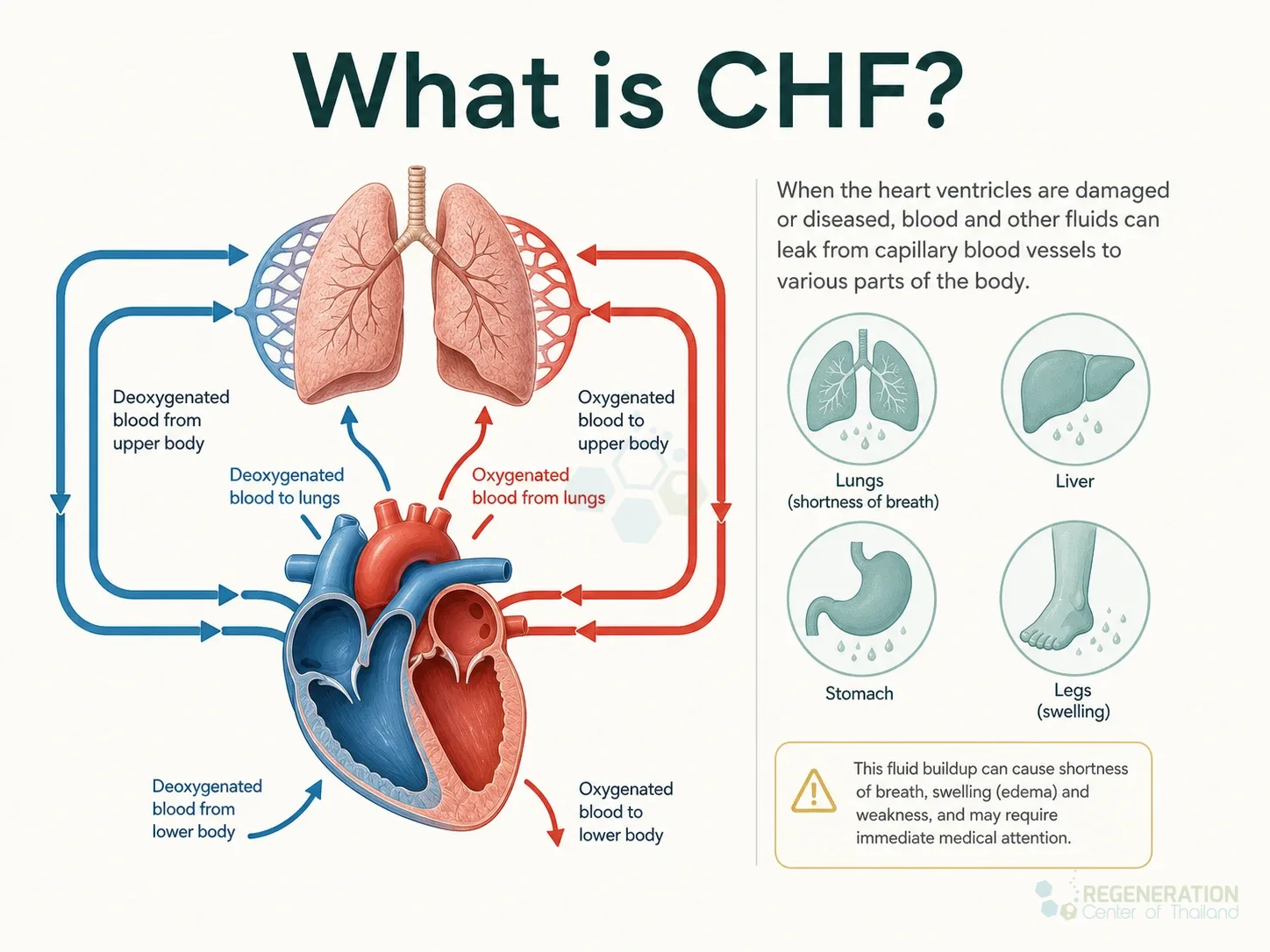 Clinical editorial image for What is CHF?, including the section headline.