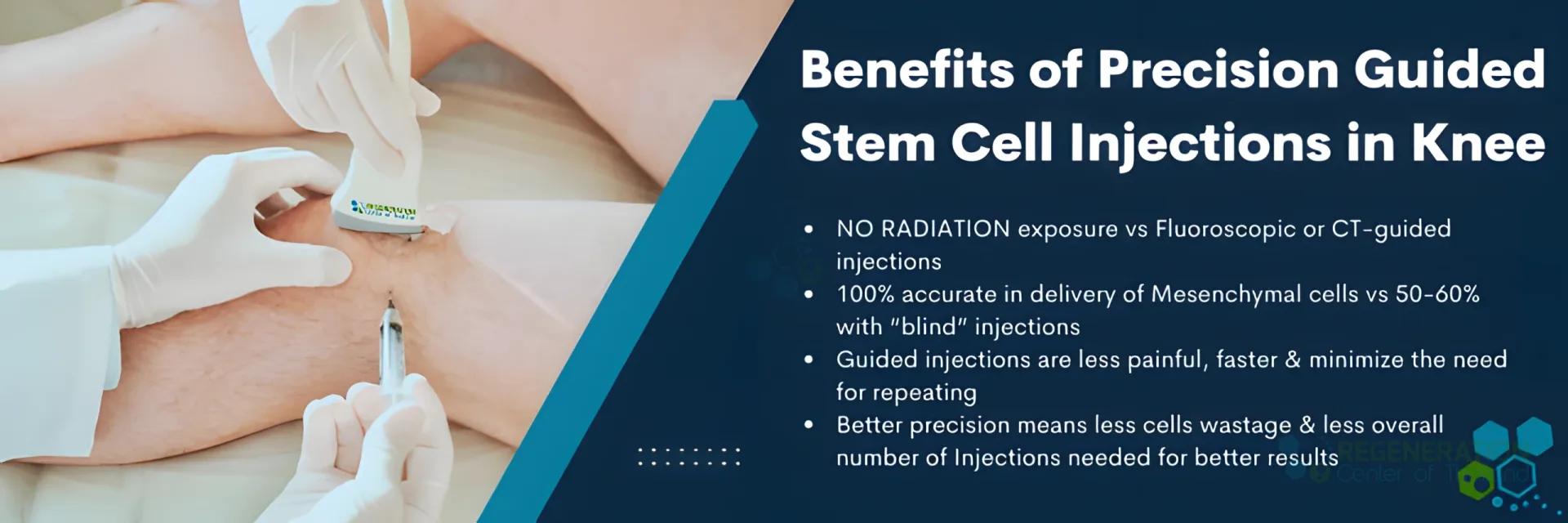 Enhanced visual alternative for Ultrasound-guided-stem-cell-injections-knee