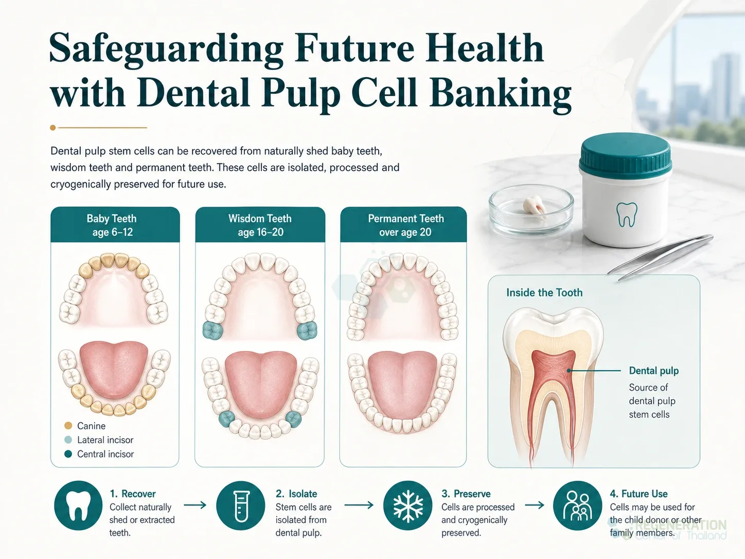 Diagram showing dental pulp stem cell recovery from baby, wisdom and permanent teeth for Dental Pulp Derived Stem Cell Extraction,Preservation & Use.