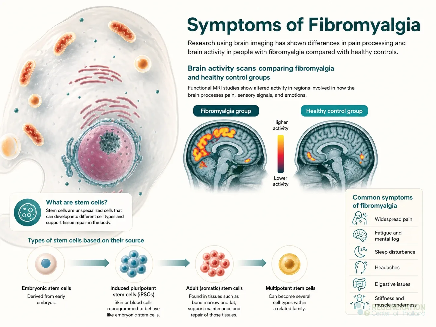 Editorial image for Symptoms of Fibromyalgia, including the section headline.