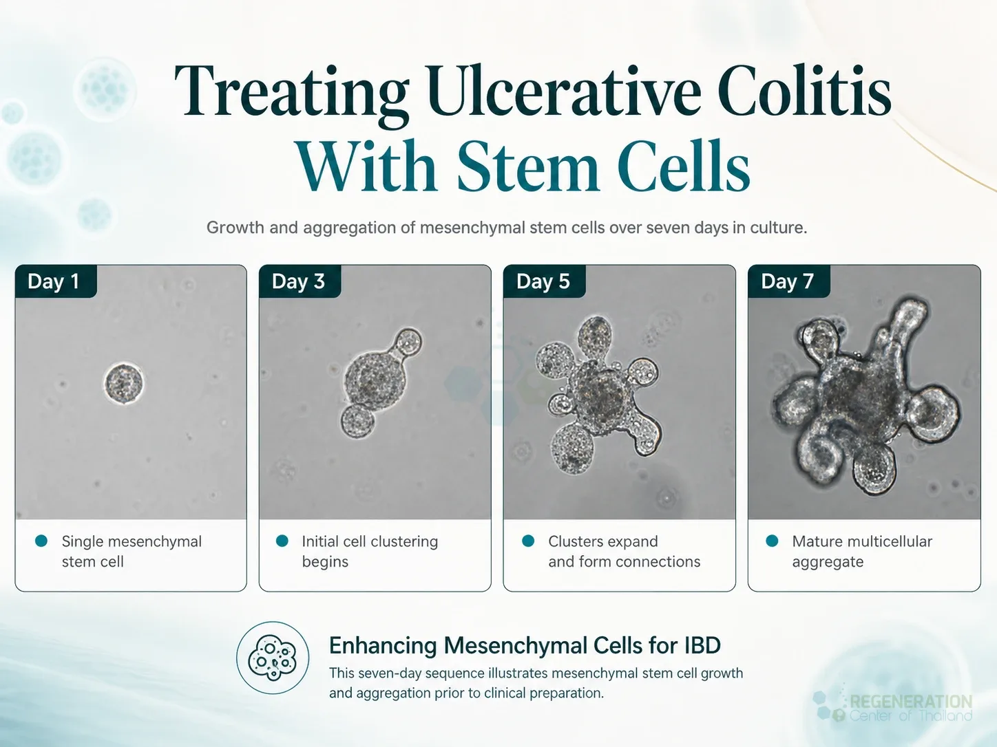 Editorial image for Treating Ulcerative Colitis With Stem Cells, including the section headline.