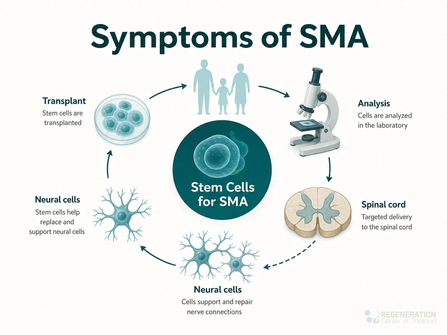 Clinical editorial image for Symptoms of SMA, including the section headline.