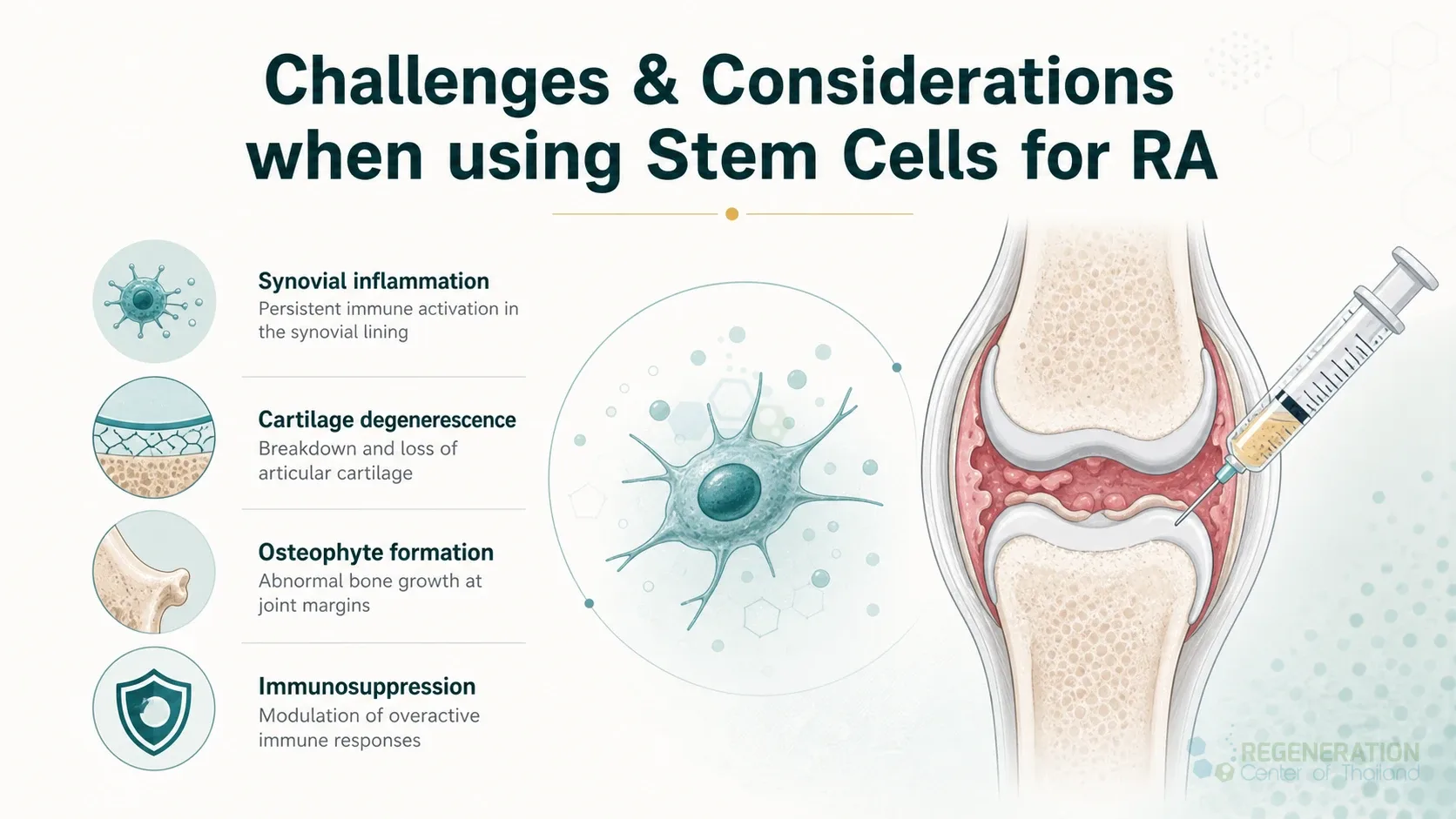 Clinical editorial image for Challenges & Considerations when using Stem Cells for RA, including the section headline.
