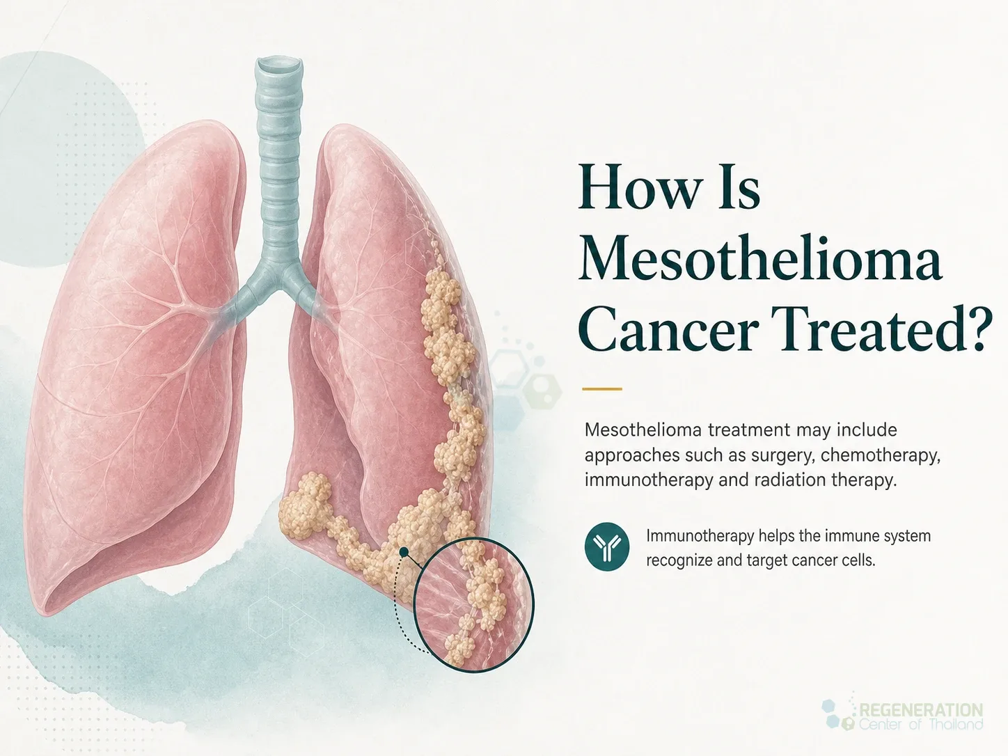 Clean clinical illustration for How Is Mesothelioma Cancer Treated? with concise explanatory text.