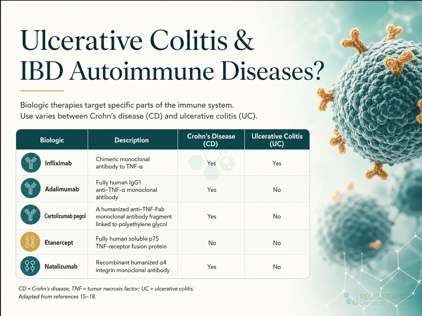 Clinical editorial image for Ulcerative Colitis & IBD Autoimmune Diseases?, including the section headline.
