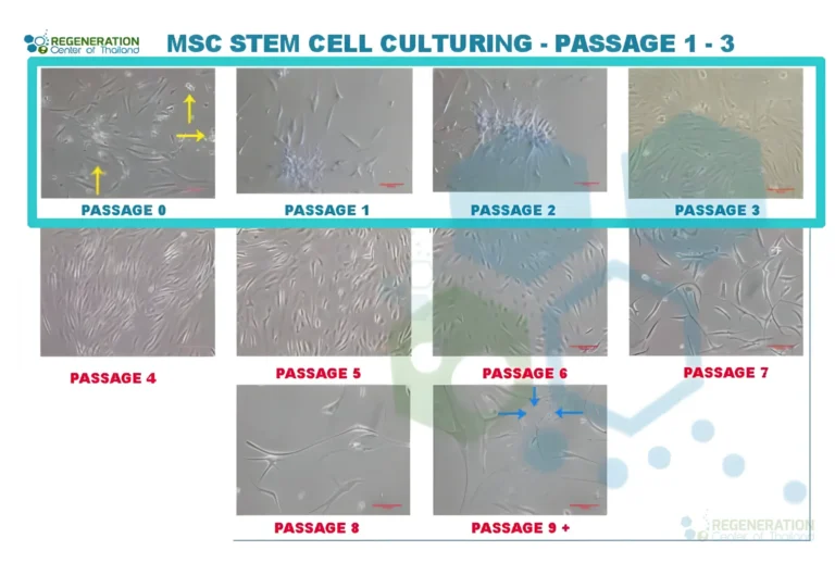 Enhanced visual alternative for PassageCount-REGENERATION-CENTER