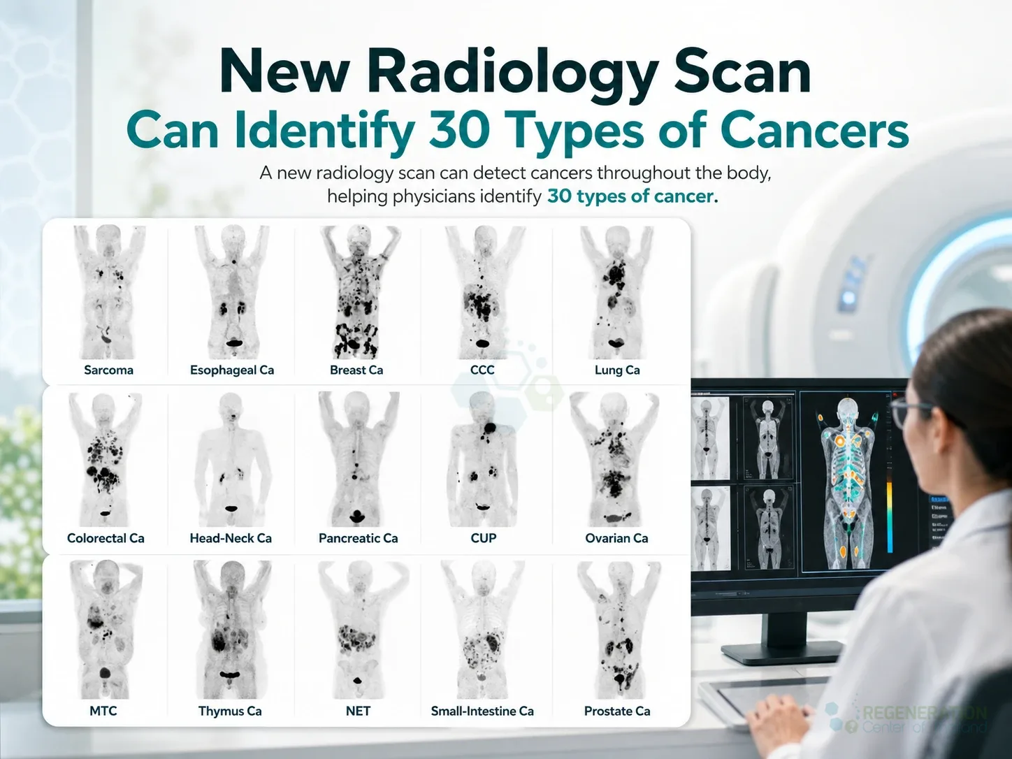 ct scan for types of cancers for New Radiology Scan Can Identify 30 Types of Cancers.