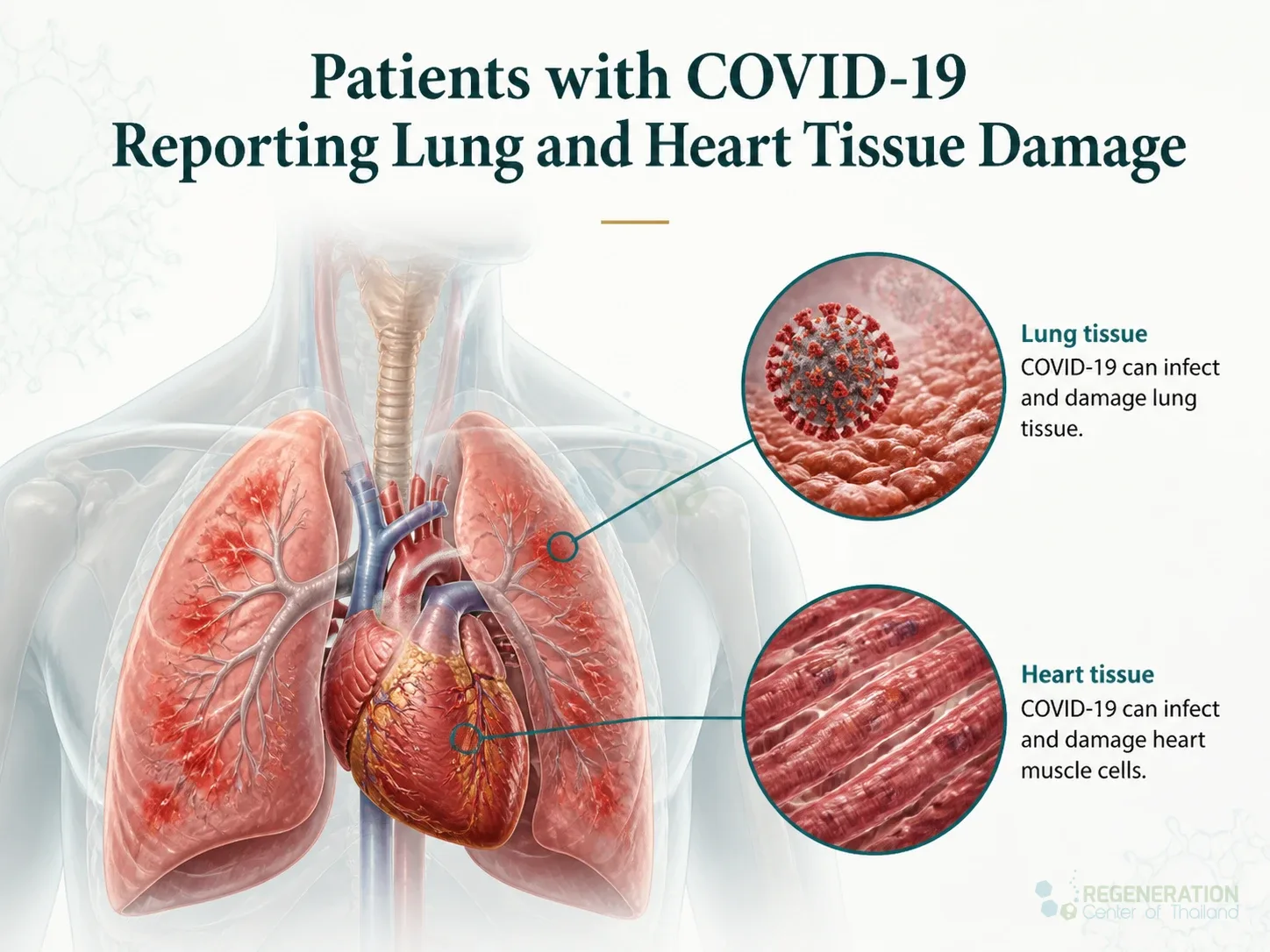 Coronavirus infection affecting the lungs