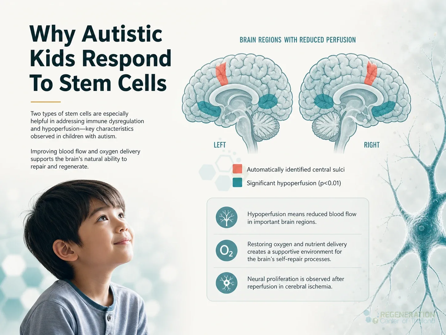 Clinical editorial image for Why Autistic Kids Respond To Stem Cells, including the section headline.