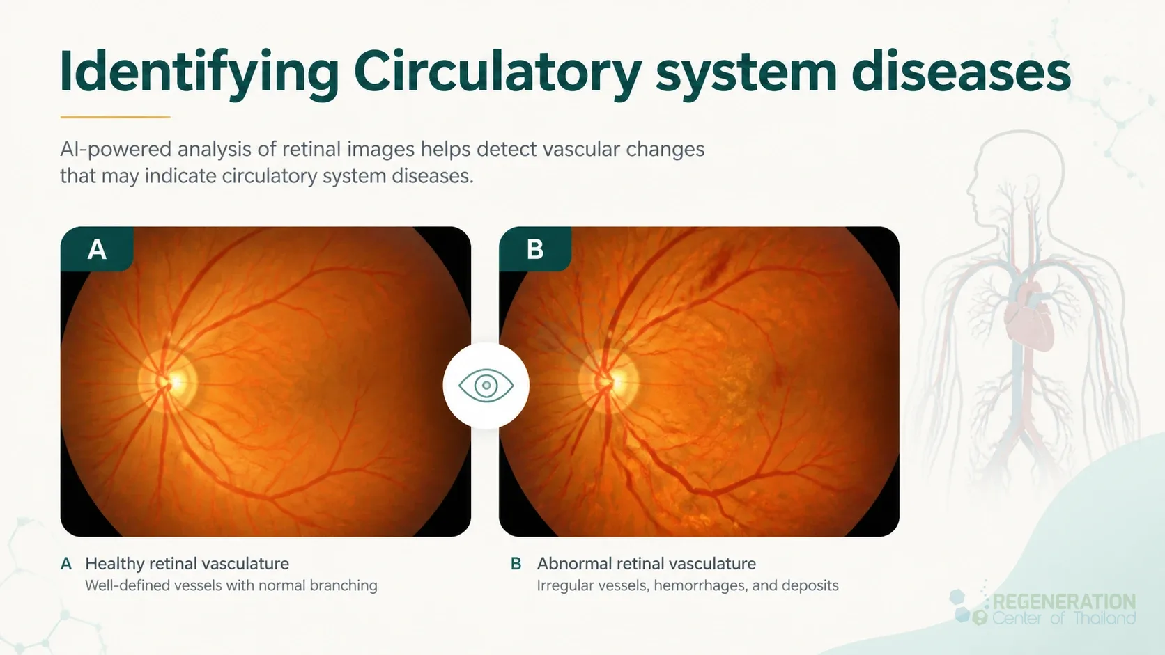 Retinal imaging for circulatory disease analysis, unverified draft for editorial review