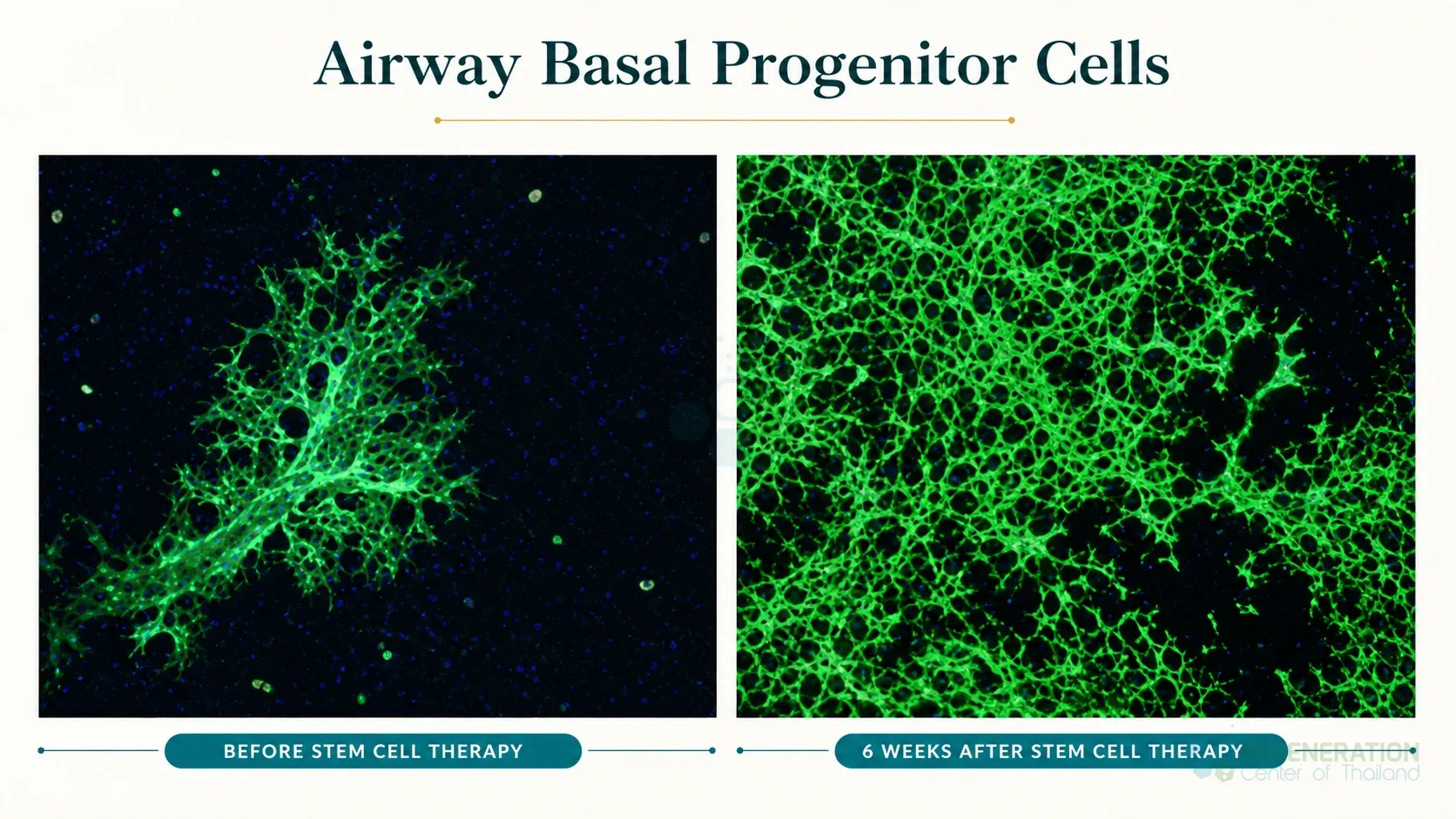Editorial image for Airway Basal Progenitor Cells, including the section headline.