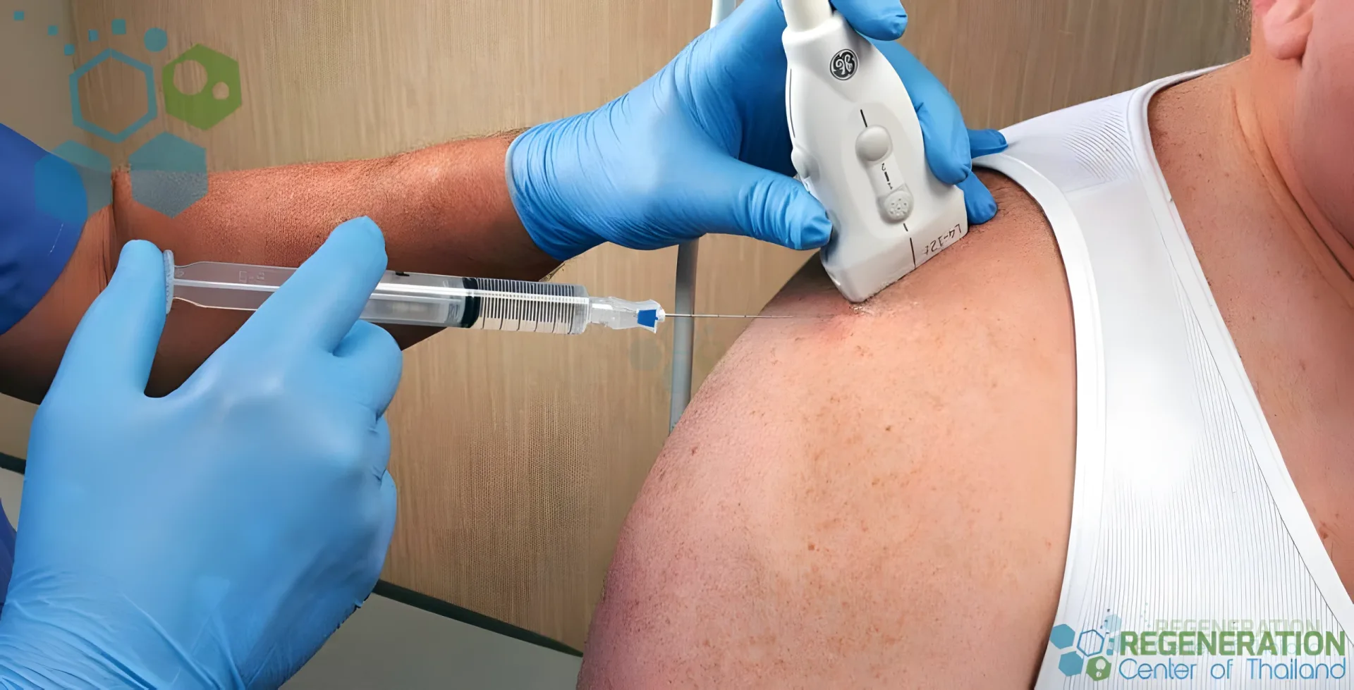 Enhanced visual alternative for stemcell-shoulder-injection-regeneration-center