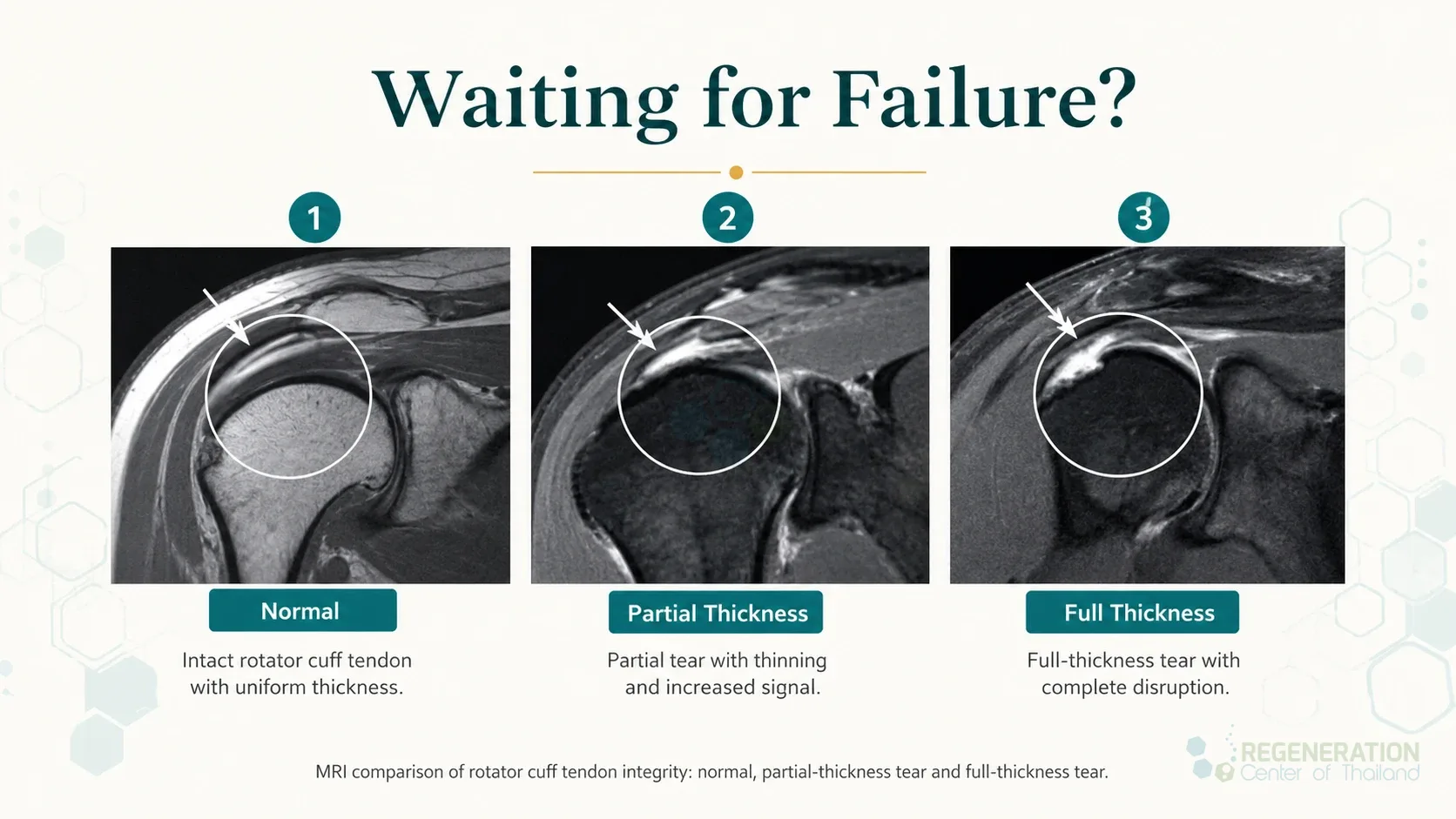 Clean clinical illustration for Waiting for Failure? with concise explanatory text.