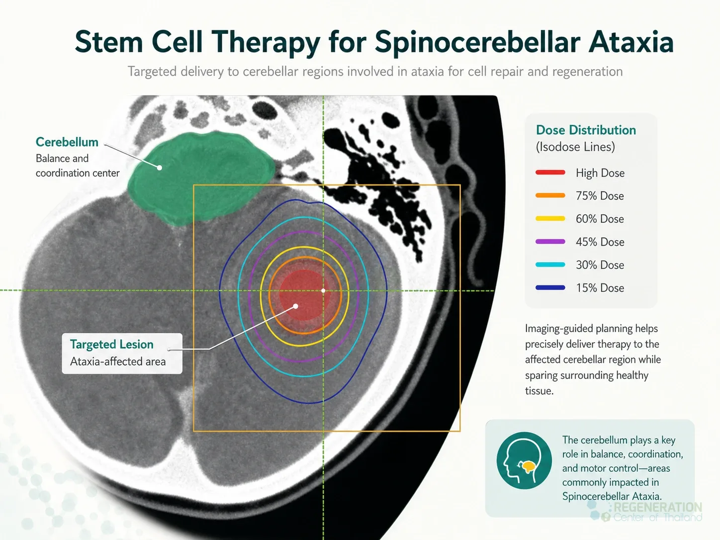 Editorial image for Stem Cell Therapy for Spinocerebellar Ataxia, including the section headline.