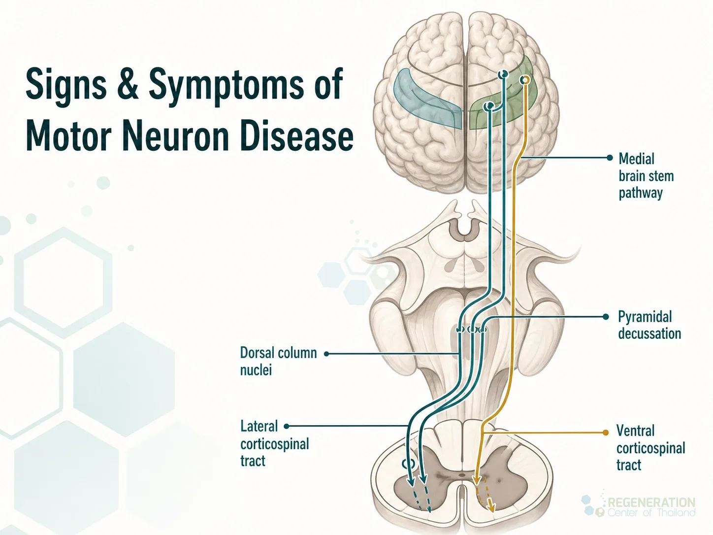 Editorial image for Signs & Symptoms of Motor Neuron Disease, including the section headline.