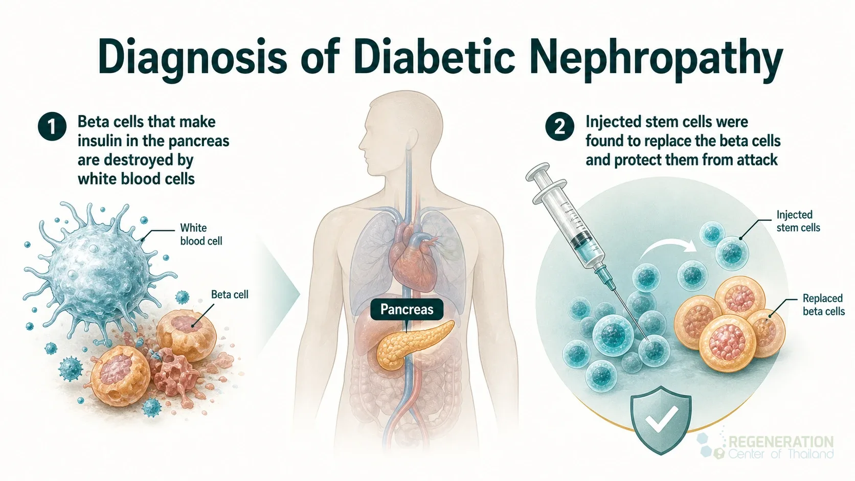 Clinical editorial image for Diagnosis of Diabetic Nephropathy, including the section headline.