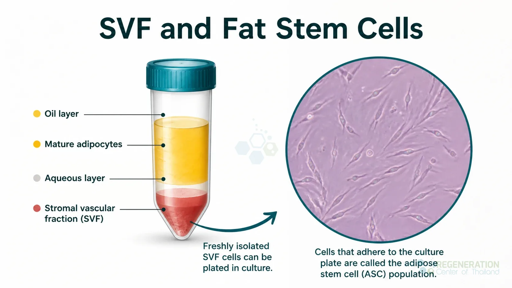 Stromal vascular fraction and adipose cell concept, unverified draft for editorial review