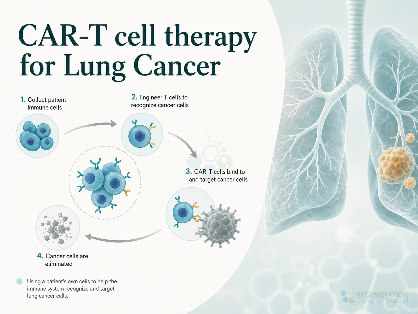 Clean clinical illustration for CAR-T cell therapy for Lung Cancer with concise explanatory text.