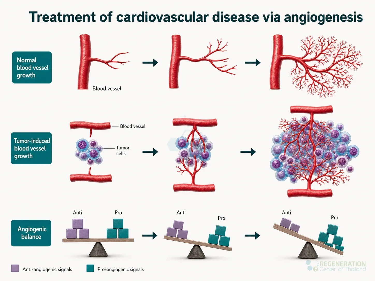 Diagram comparing blood vessel growth under pro- and anti-angiogenic signals for The Angiogenesis Process and Its Therapeutic Benefits.