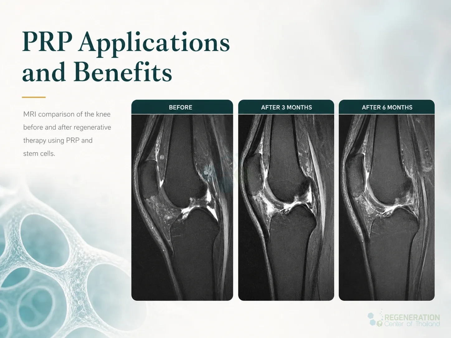 Editorial image for PRP Applications and Benefits, including the section headline.