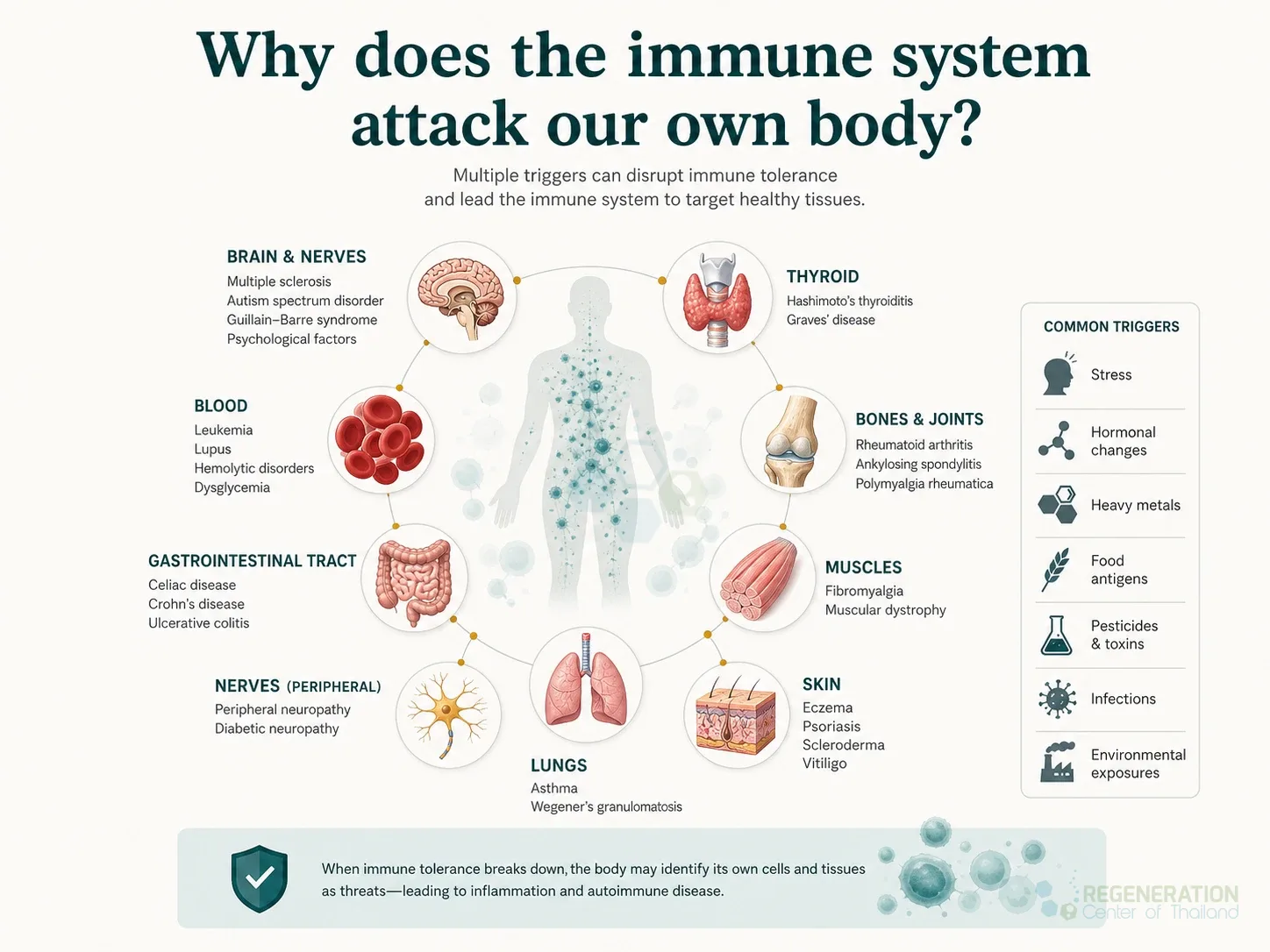 Types-Autoimmune-Disease-Treatment-Stem-Cells for UC-MSC+ Stem Cell Treatment for Autoimmune Diseases in 2026.