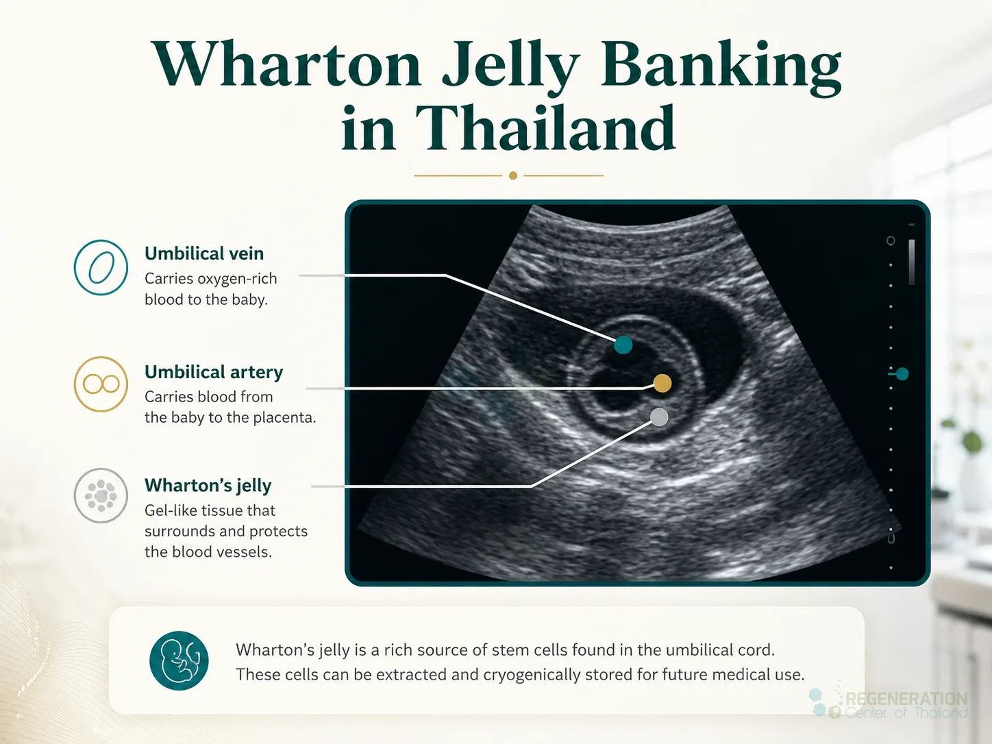 Ultrasound image labeling the umbilical vein, umbilical artery and Wharton’s jelly for Wharton Jelly Amniotic Membrane Stem Cell Banking.