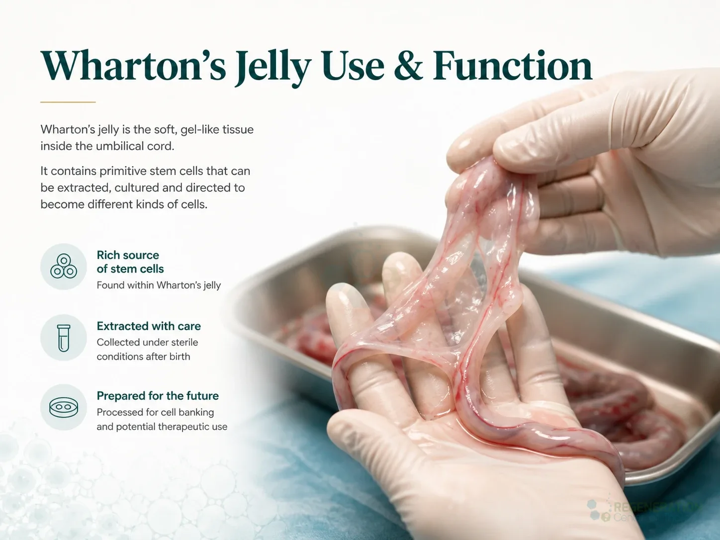 Umbilical cord tissue held after delivery for Wharton’s jelly collection for Wharton Jelly Amniotic Membrane Stem Cell Banking.